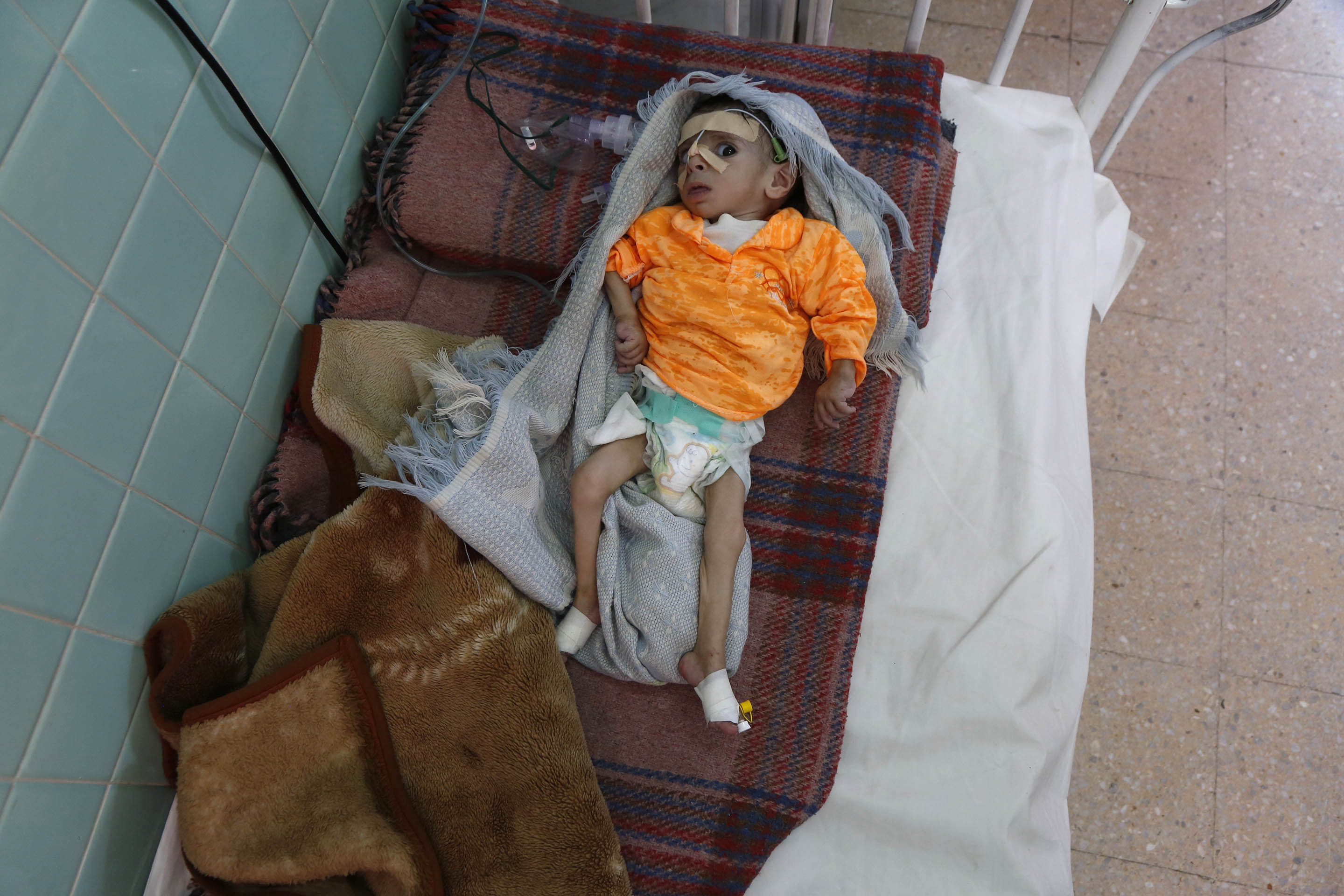 250,000 Yemenis at the brink of starvation