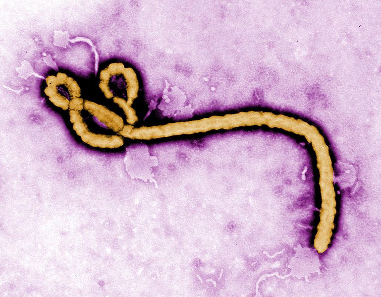 US: New test can identify every virus in humans and animals