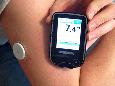 Diabetics denied access to blood glucose monitors