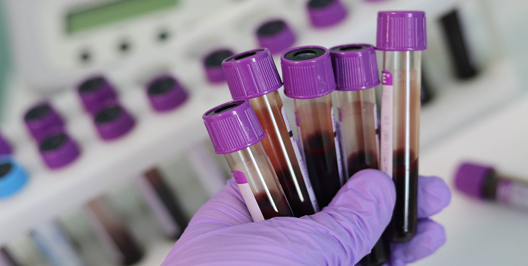 Health and Science: Lab-grown blood to start clinical trials in UK