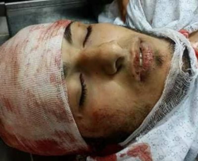 Palestine: Israeli troops kill 17, injure over 1400 Palestinians during peaceful protest