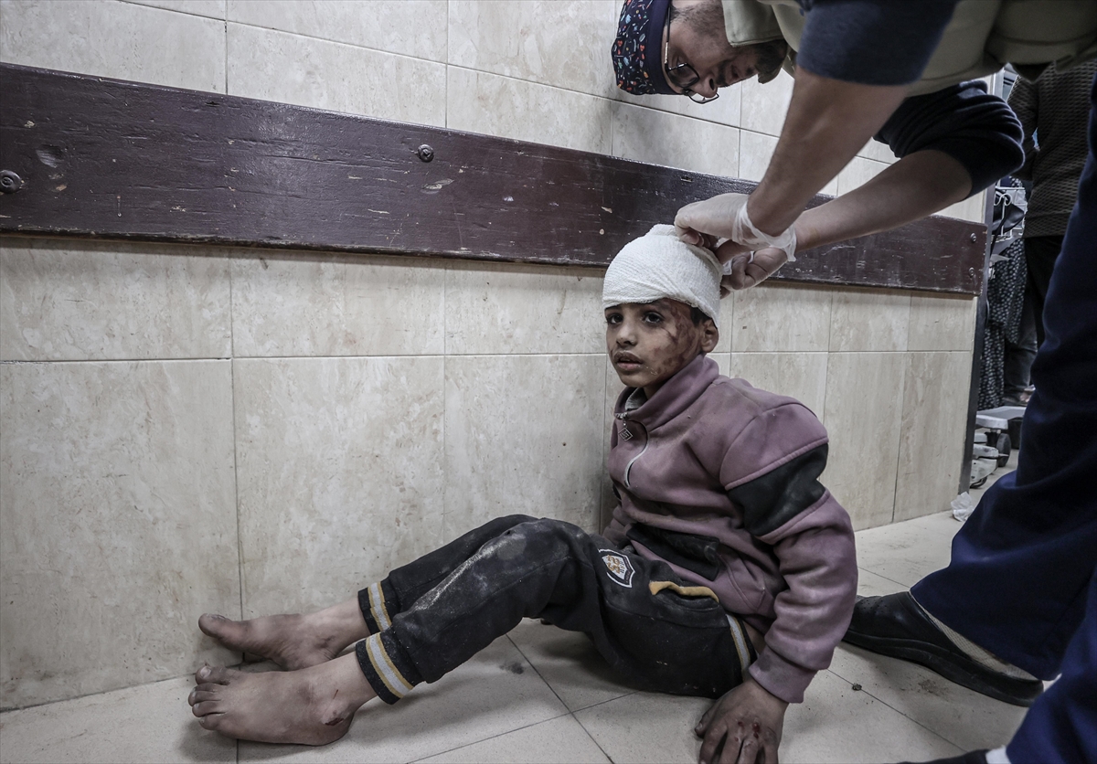Gaza: 150 Palestinians were killed, 313 wounded by Israeli attacks in past 24 hours