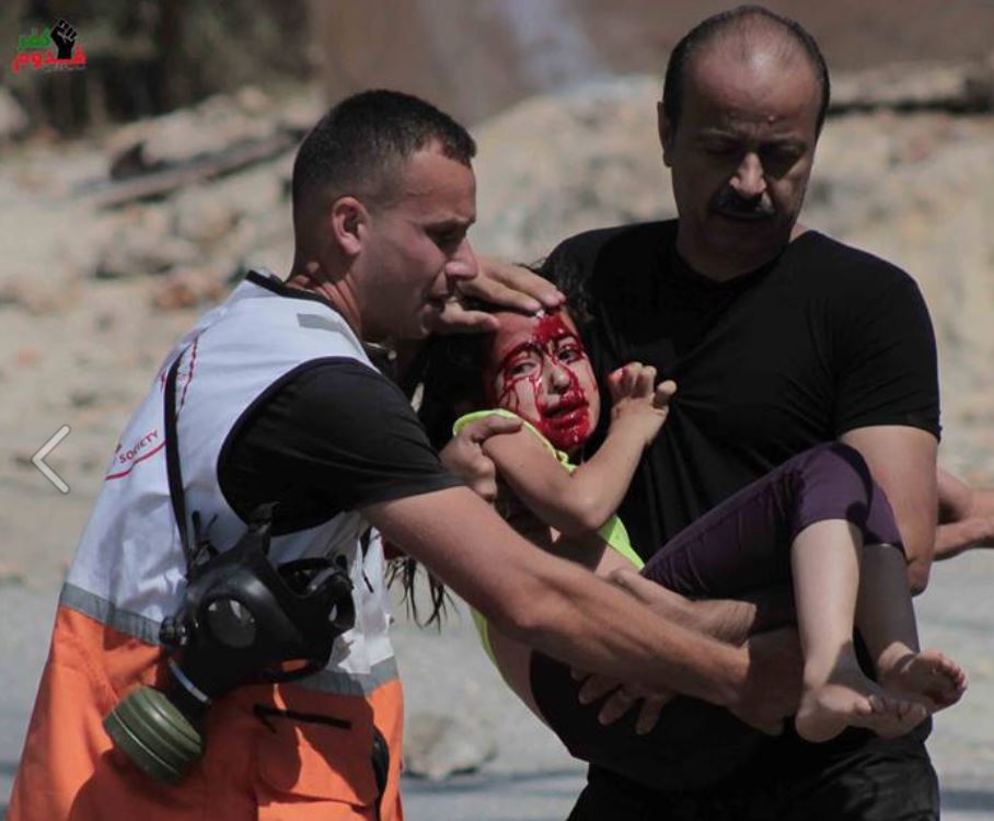 Palestine: Nablus police chief, daughter injured by Israeli fire