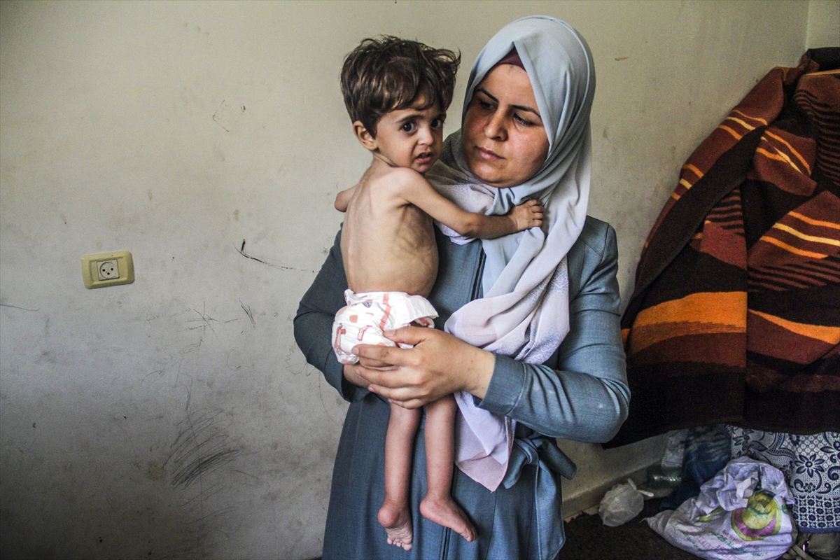 Gaza:  40 Palestinians killed, 218 injured by Israeli indiscriminate bombings last 24hrs