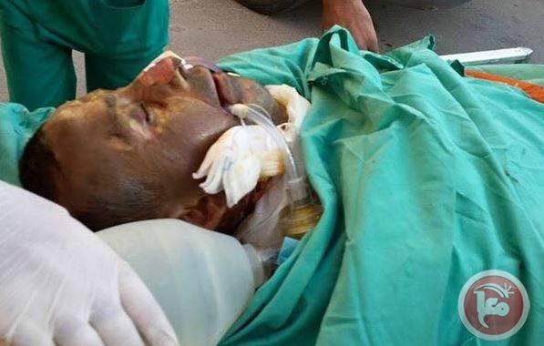 Palestine: 8-month-old baby burnt to death by Israeli settlers near Nablus