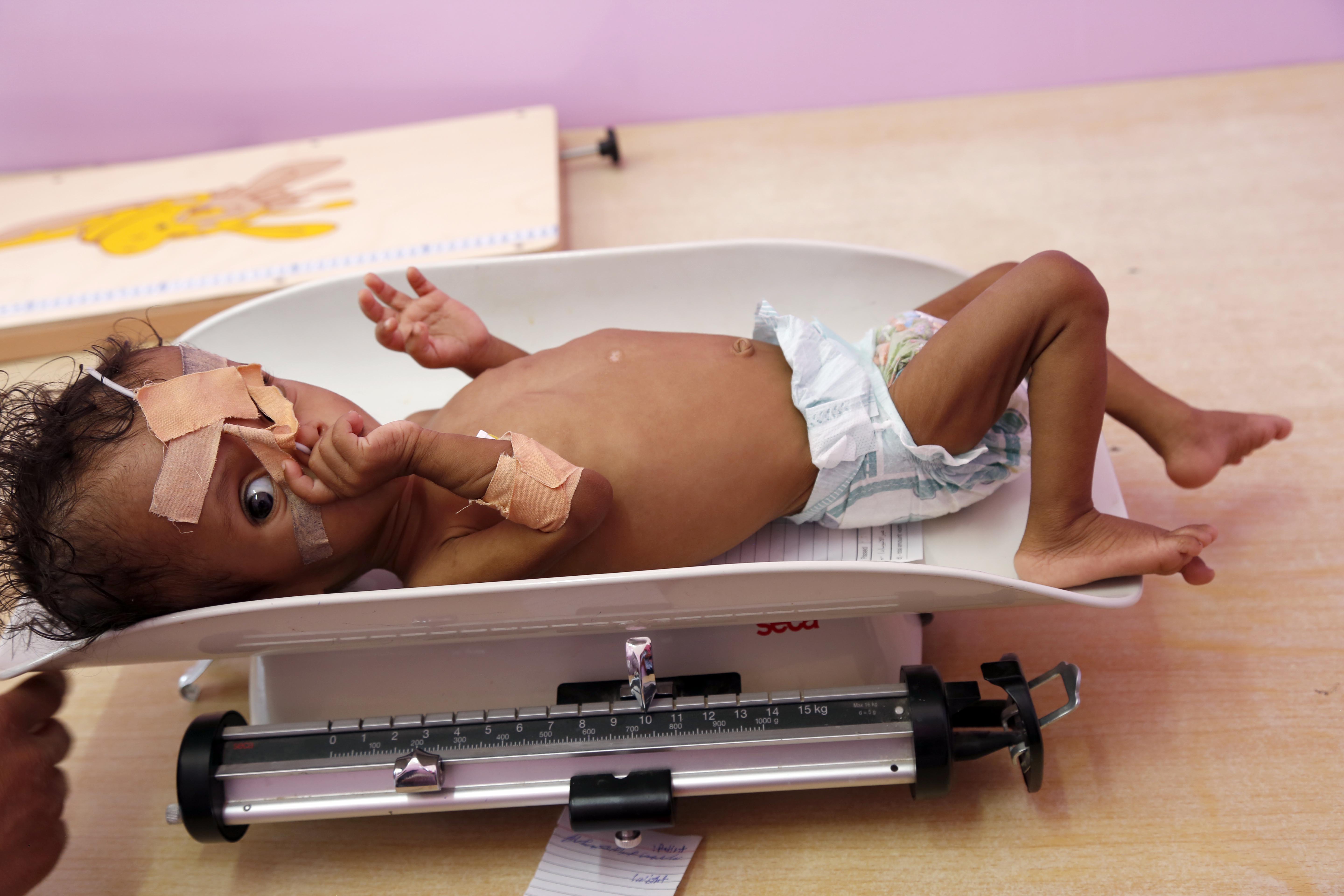 UN chief says at least 10K children killed in Yemen conflict