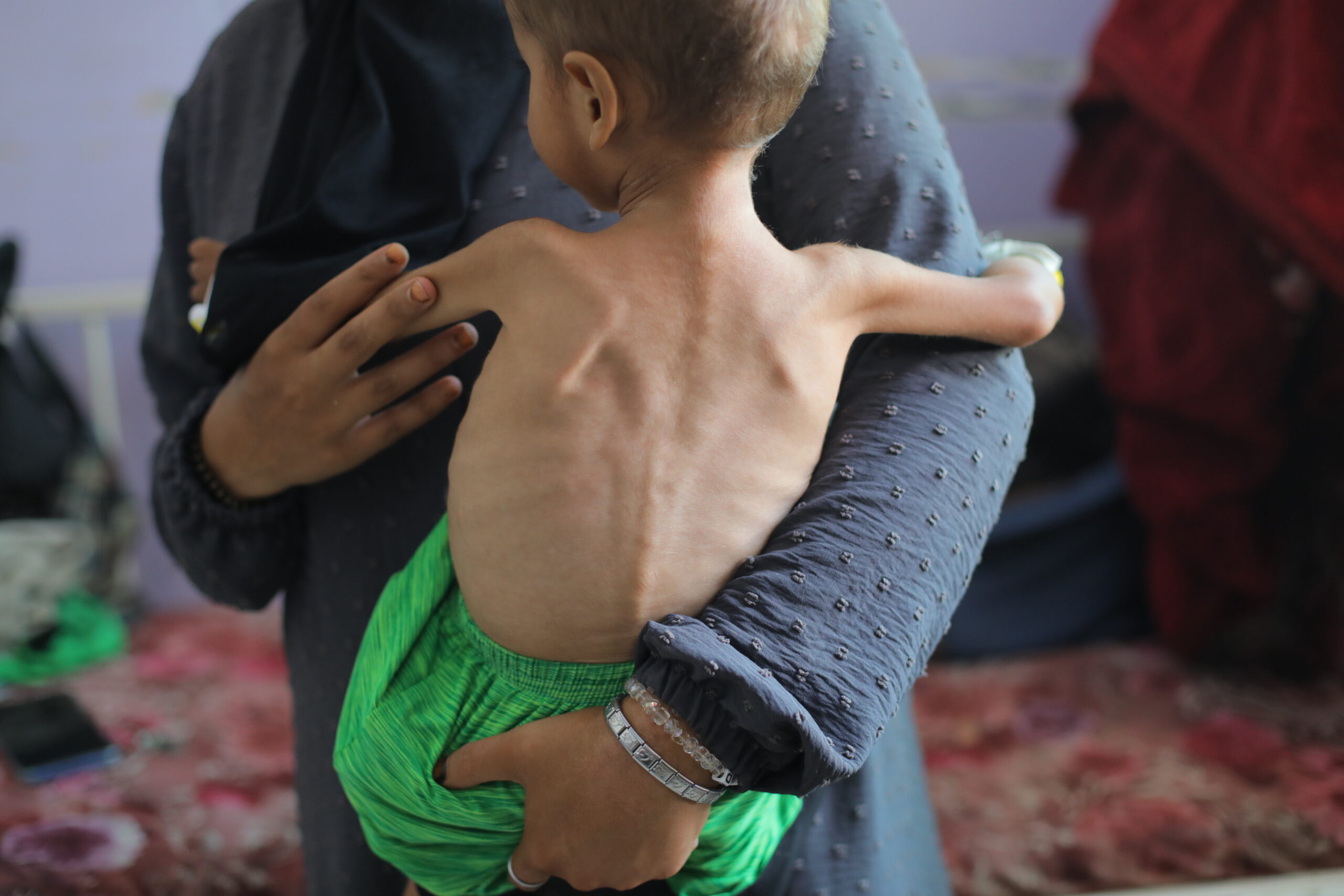 Editorial – Weaponised famine in Gaza: a starvation of conscience in the West