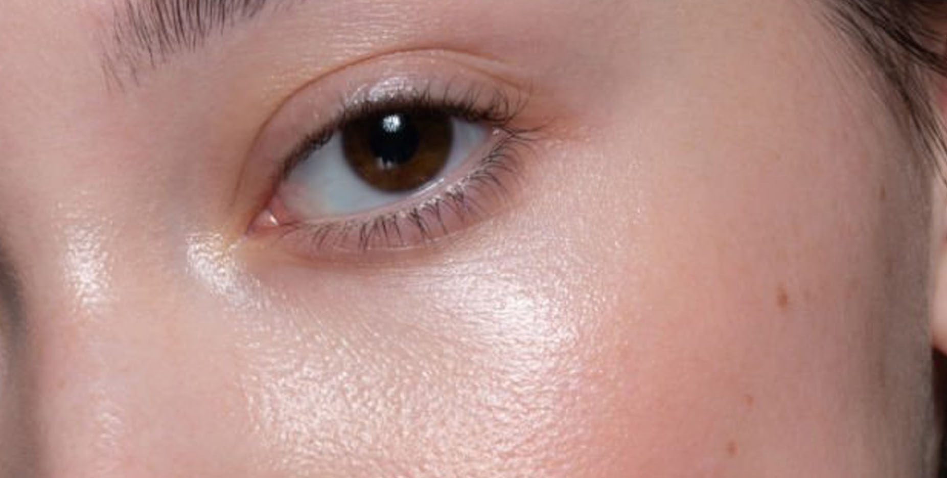 Nutrition: Connection between diet & skin health